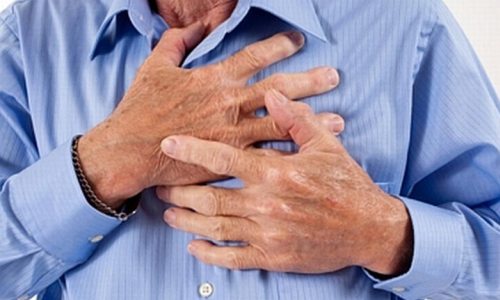 Как часто случаются бессимптомные инфаркты?
