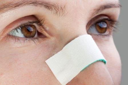 Искривление носовой перегородки: причины, последствия, лечение