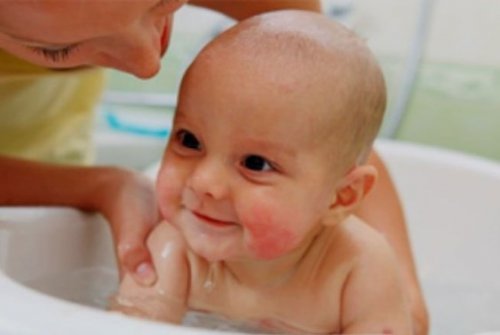 Профилактика и лечение диатеза на щеках у ребенка
