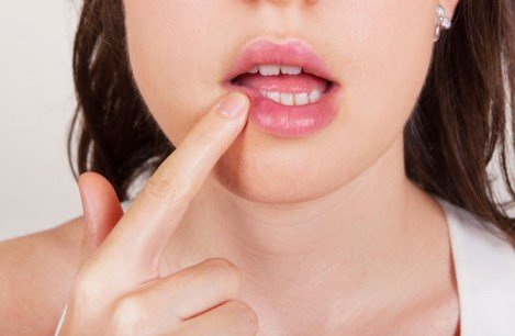 Когда возникает аллергический отек губы и как лечится