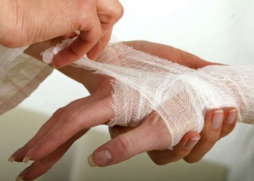 Вывих пальца руки и ноги: симптомы и лечение