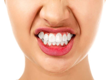Лечение скрежетания зубами (бруксизма)