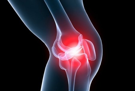 Как лечить растяжение связок коленного сустава?