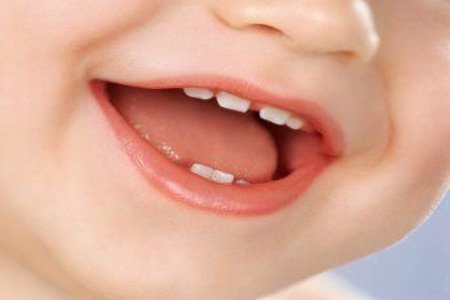 Нужно ли лечить молочные зубы
