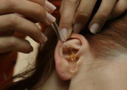 Капли от боли в ушах – можно ли их применять самостоятельно?