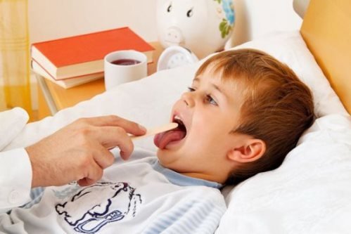 Причины и лечение герпетической ангины у детей