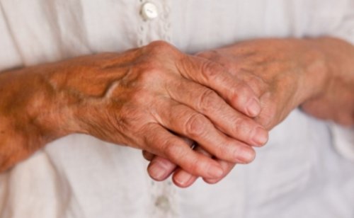Лечение артрита пальцев рук в домашних условиях