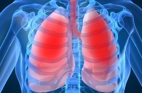 Очаговая Пневмония – Причины и Способы Лечения