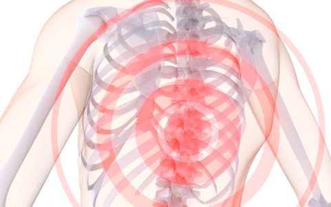 Лечение шейно грудного остеохондроза