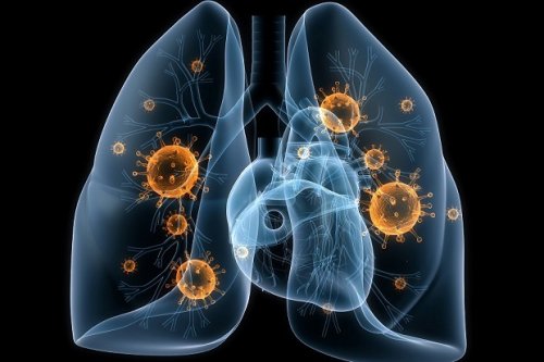 Как проявляется пневмония у взрослых – основные причины и последствия неправильного лечения