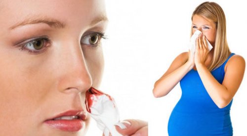 Причины, вызывающие кровь из носа при беременности