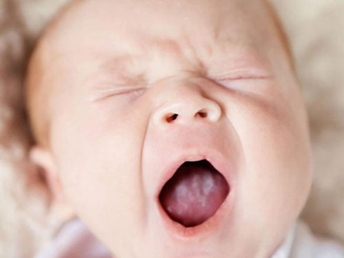 Появление молочницы во рту у новорожденных и его лечение