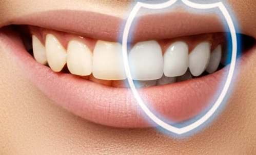 Фторирование зубов: зачем нужно?