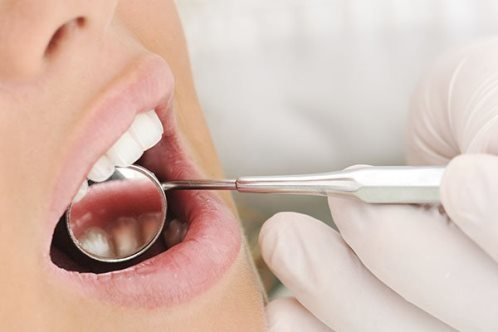 Кариес зубов. Симптомы, причины и лечение