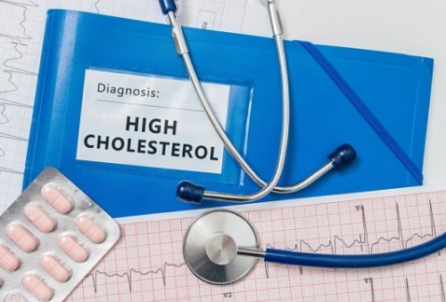 Высокий холестерин: что это значит и как с этим бороться?